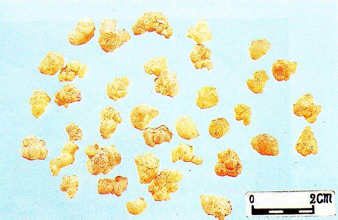 Boswellia Serrata Extract